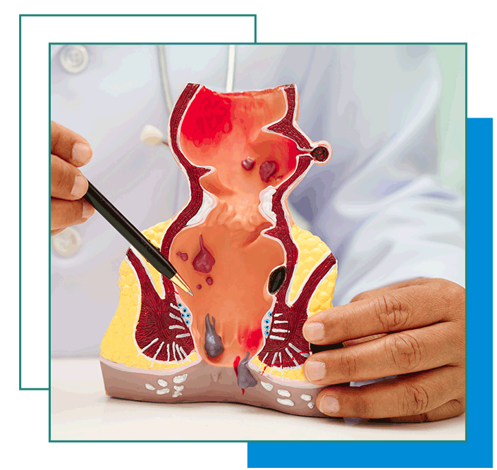 Proctology Laser Machine Manufacturers in Ahmedabad